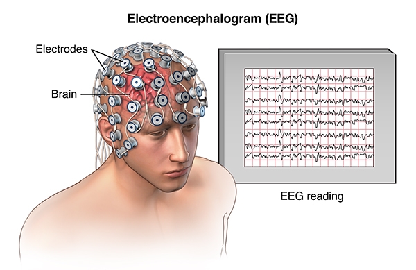 drpierresblog,seizure